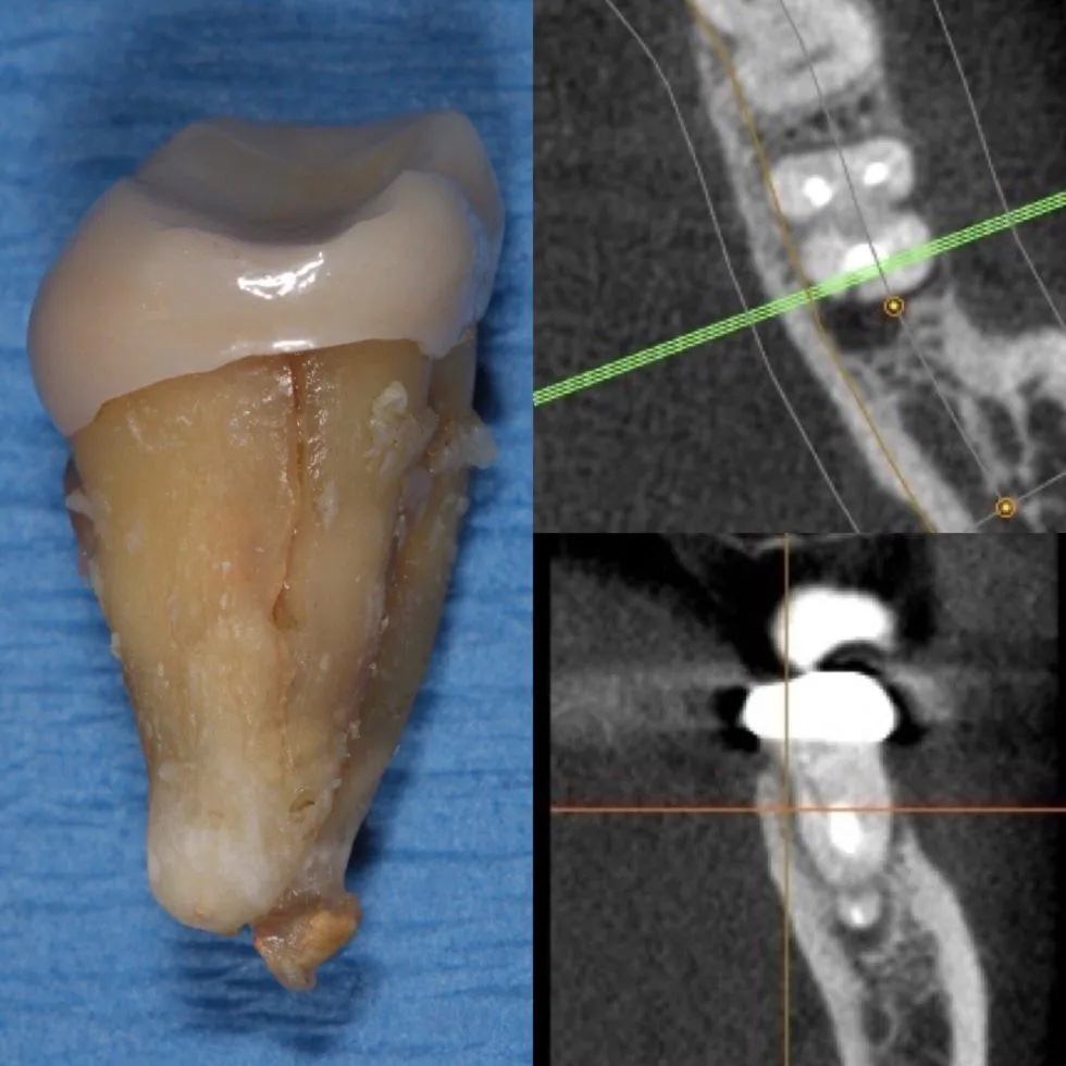 CT Scan2