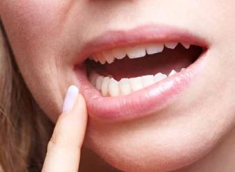 Oral cancer awareness: Self-screening